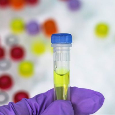 InFLAMES-lippulaiva vahvistaa osaajapohjaansa – haussa innovatiivisia immunologian osaajia professoreista projektitutkijoihin