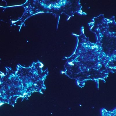 Novel Antibody Drug Wakes Up the Body’s Defense System in Advanced-stage Cancer