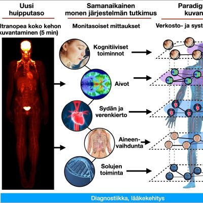 Turun PET-keskukselle koko kehon PET-kamera: myös lääkekehitys hyötyy