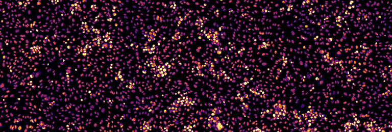 From star charts to microscopes: new tool solves imaging challenges with the help of astronomy
