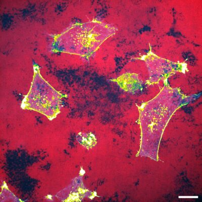 New visualisation tool helps researchers to target breast cancer dissemination